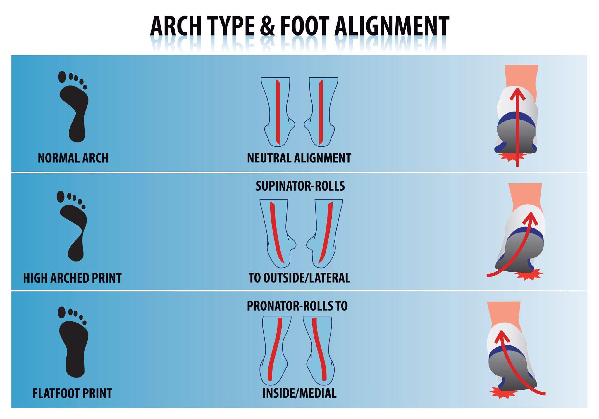 Flat Feet vs High Arches: What’s the Difference and Which Insoles Help Most?